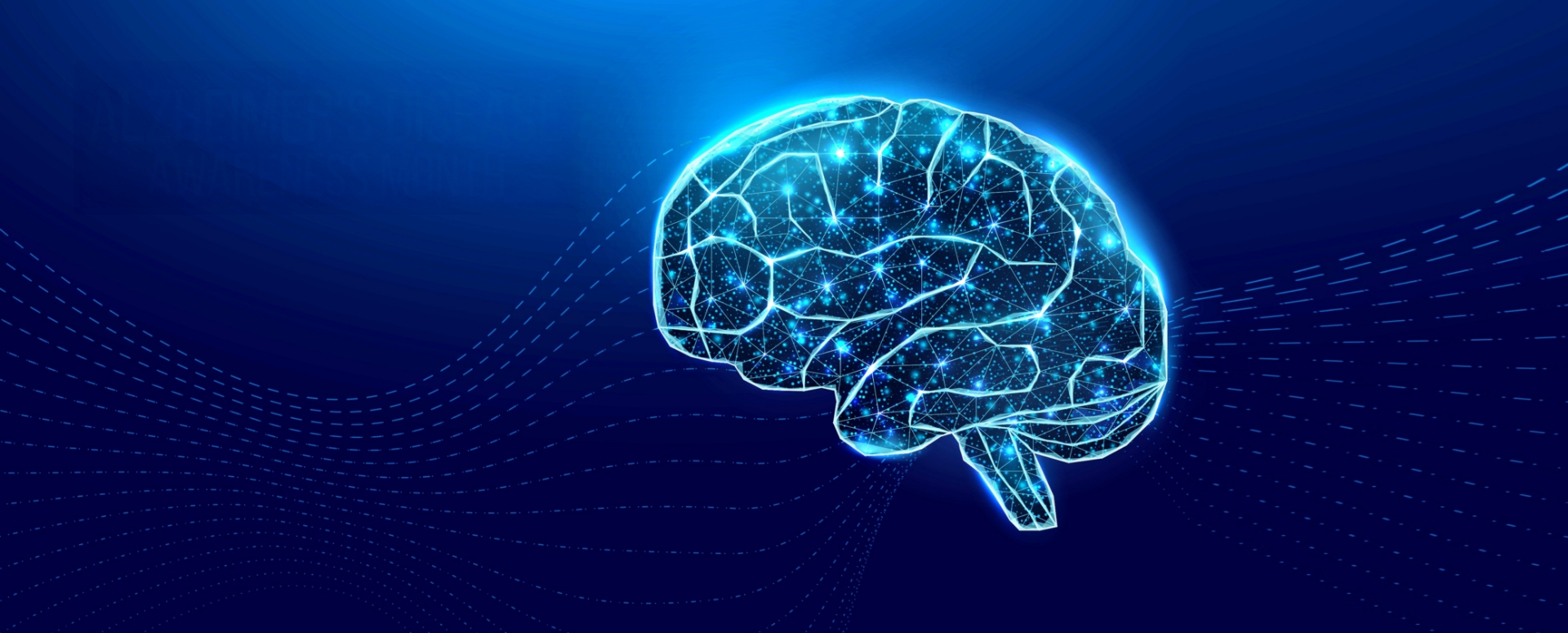 מהם ״תאי ג׳ניפר אניסטון״ במוח?