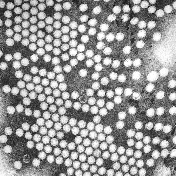 חצבת בישראל, חיסוני פוליו בעזה: מחלות ללא גבולות