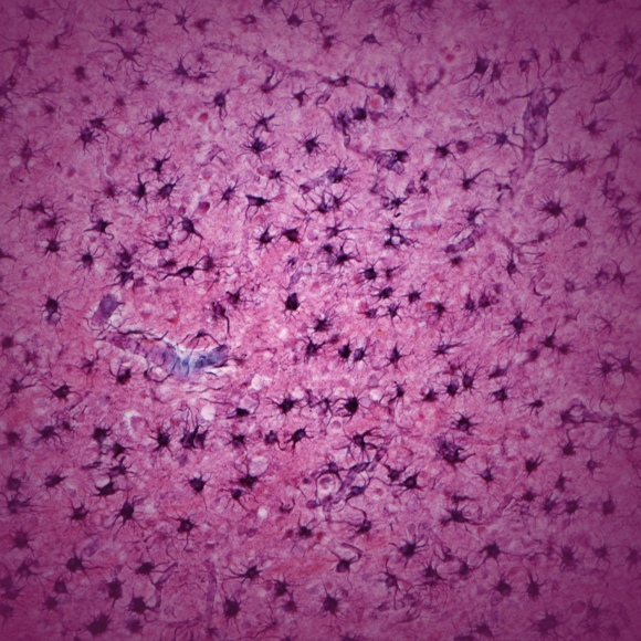 בדרך לטיפול במחלות פריונים?