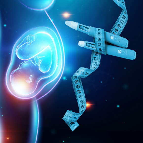 האם יש יותר הריונות בגלל אוזמפיק ודומותיה?