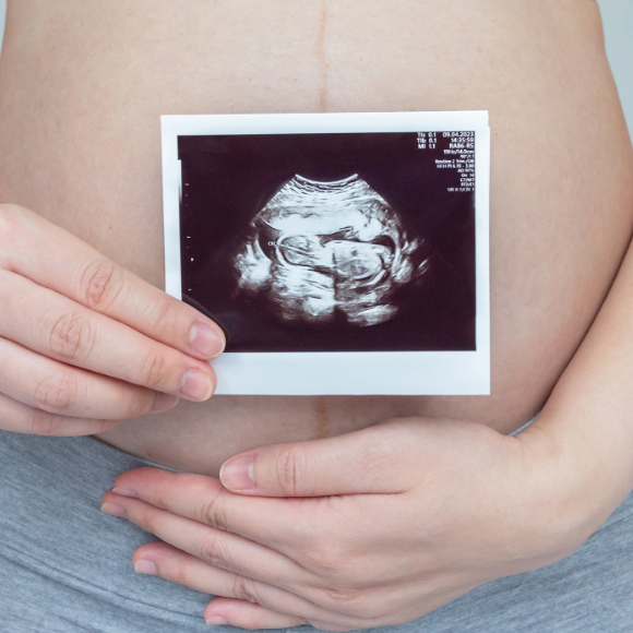 20 השתלות רחם, 16 תינוקות