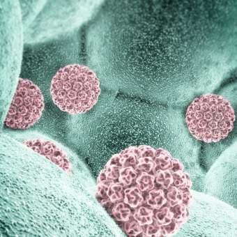 נגיפי פפילומה נגד סרטן העור