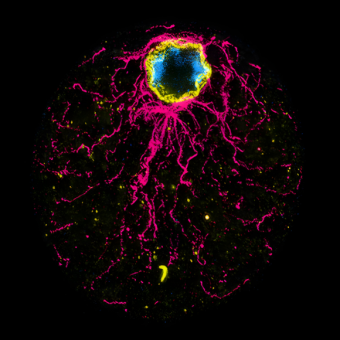 המנגנון שהקדים את זמנו