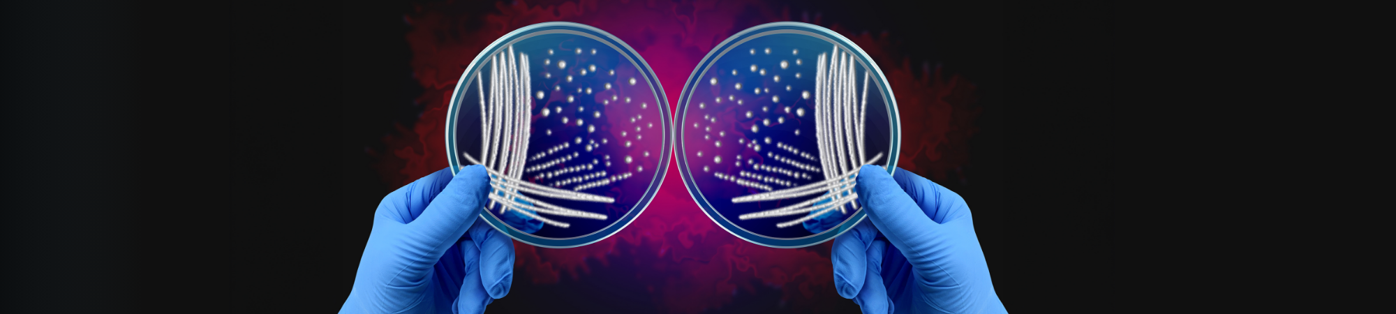 חיידקים בארץ המראה