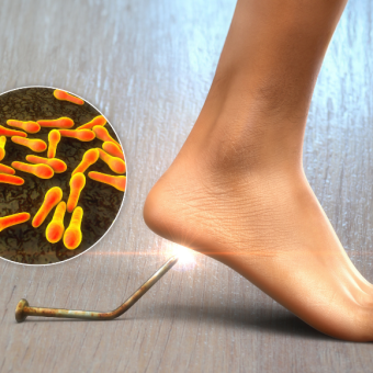 مرهمٌ بكتيريّ ضد الكزاز