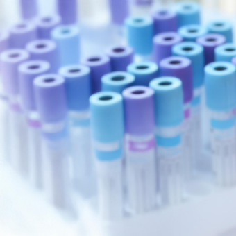 מחלות ללא גבולות: אבולה באוגנדה