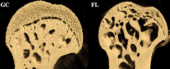 שינוי בולט בצפיפות העצם. ראש עצם הירך של עכברה אחרי 37 ימים בחלל (מימין), לעומת העצם של עכברה ששהתה בתנאים דומים בכדור הארץ | מקור: מאמר המחקר