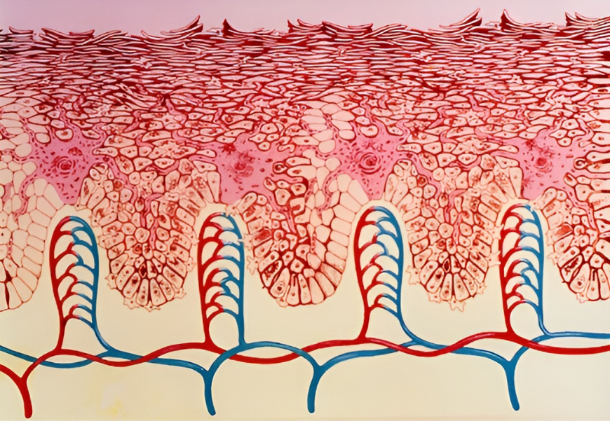 כוויית שמש היא תוצאה של מוות של תאי עור, ותגובה דלקתית בעור שמתפתחת בעקבות זאת. מבט על מבנה השכבה העליונה בעור שנכווה מהשמש | Hans-Ulrich Osterwalder / Science Photo Library