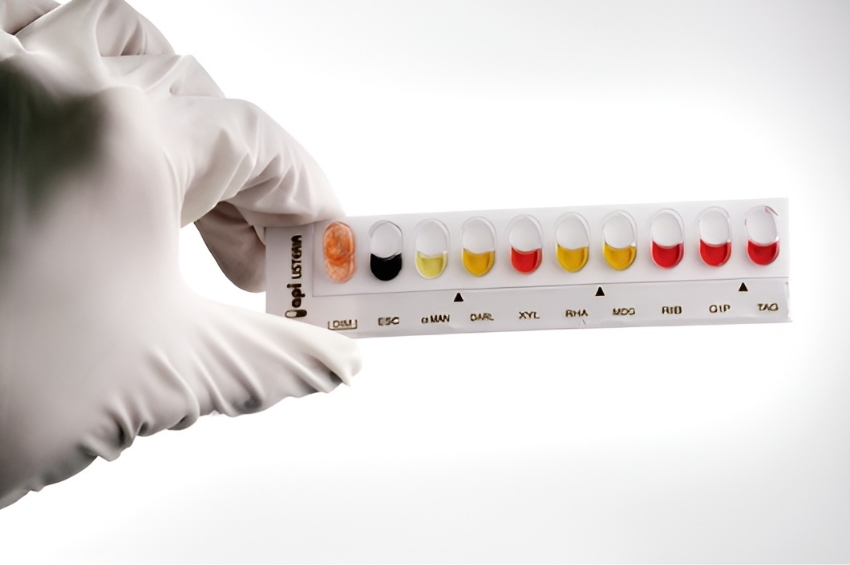 חיידק ליסטריה מונוציטוגנס עלול לגרום למחלה דמוית שפעת, ואצל אנשים עם מערכת חיסון מוחלשת או קשישים הוא גם יכול להיות מסוכן. בדיקה לזיהוי חיידקי ליסטריה | Shutterstock, Tim Vernon, LTH NHS Trust / Science Photo Library