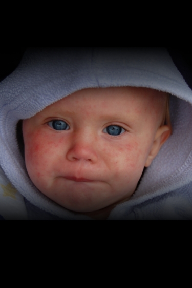 כולרה ביבוא אישי: מחלות ללא גבולות