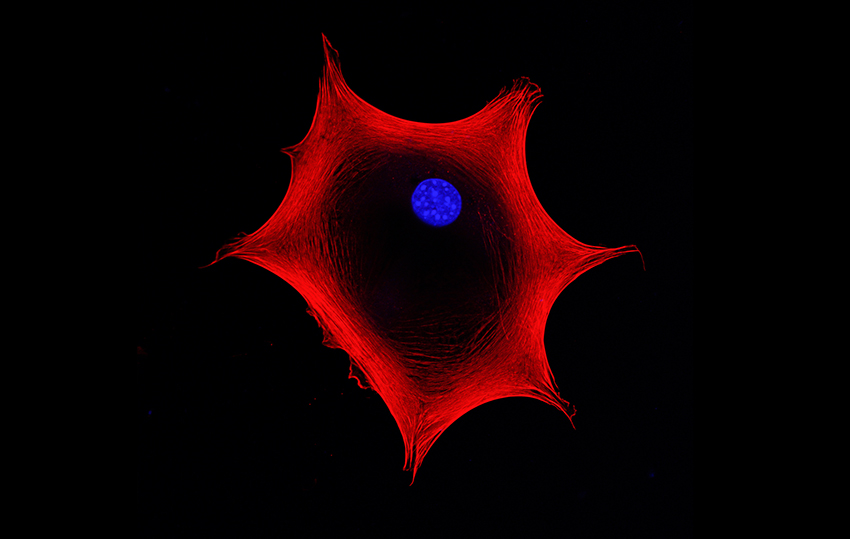 תא רגיל שהוסב גנטית למצבו הראשוני באמצעות החדרת גֵנים שמבקרים את ההתמיינות שלו, מה שמאפשר לו להפוך כמעט לכל סוג תא בגוף. תא גזע פלוריפוטנטי | DrimaFilm, Shutterstock