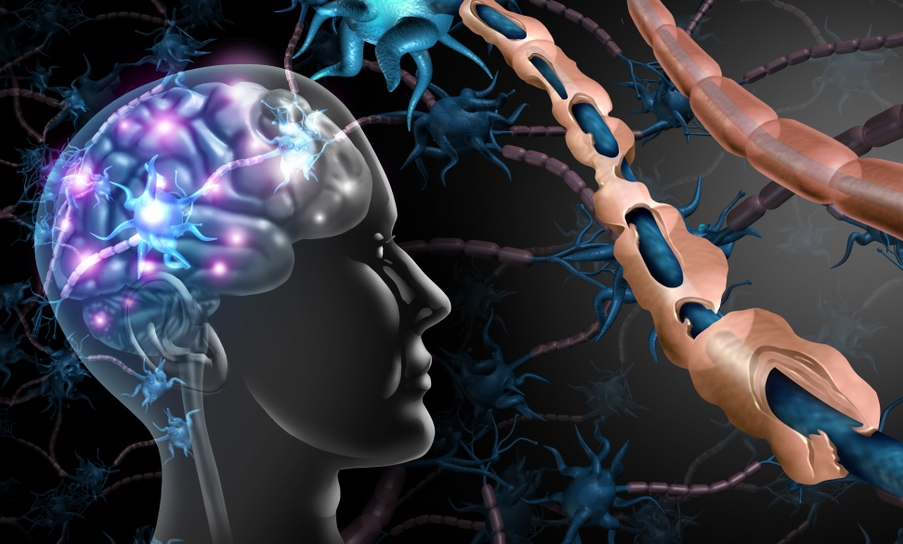 טרשת נפוצה היא מחלה אוטואימונית שבה מערכת החיסון תוקפת את המיאלין – המעטפת השומנית שמאיצה את הולכת האותות החשמליים במערכת העצבים. אילוסטרציה של הפגיעה בעצבים במחלה | Shutterstock, Lightspring