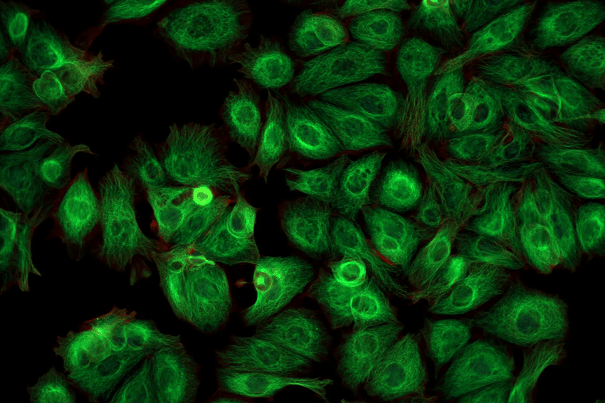 כדי לחקור פעילות של חלבון, אפשר למשל לצרף אליו חלבון פלואורסצנטי שמאפשר לעקוב אחרי תנועות החלבון בתא באמצעות מיקרוסקופ. תאים עם חלבונים פלואורסצנטיים | Shutterstock, Caleb Foster