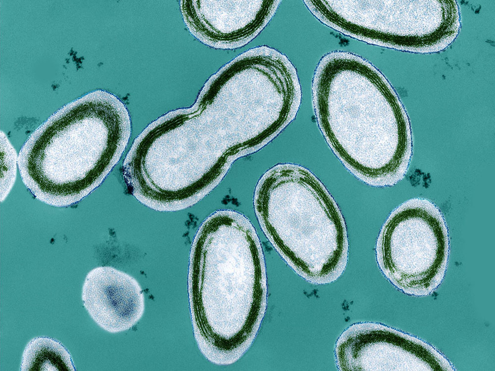 גם חיידקים כחוליים משתמשים בצינוריות זעירות להעברת חומרים מחיידק אחד לאחר. פרוכלורוקוקוס תחת עדשת מיקרוסקופ אלקטרונים חודר | מקור: CLAIRE TING / SCIENCE PHOTO LIBRARY