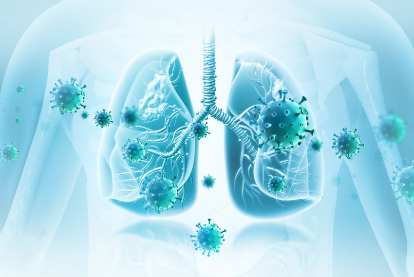 נגיפים שפועלים על מערכת הנשימה עלולים להעיר תאים סרטניים רדומים. אילוסטרציה של תאי סרטן בריאות | Shutterstock, crystal light