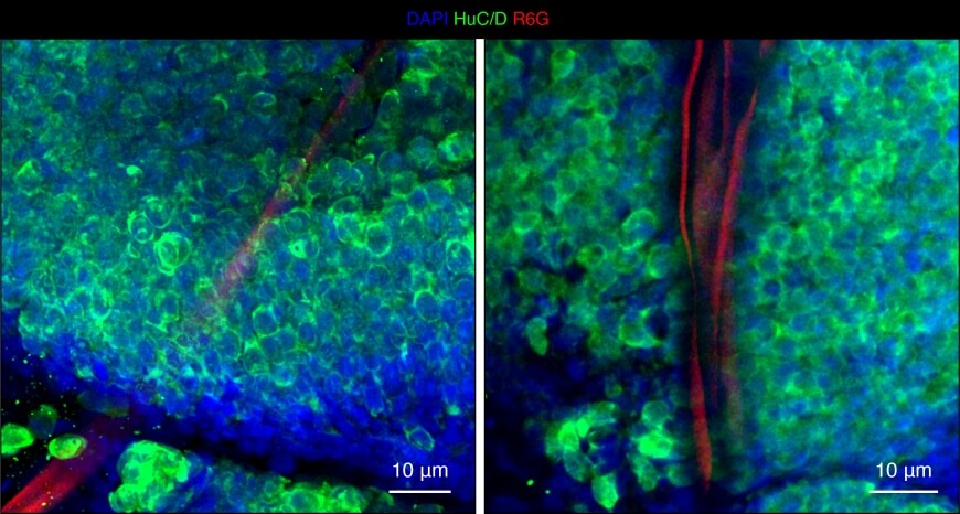המערכת מאפשרת לחוקרים לתעד ברציפות את הפעילות החשמלית של תאי עצב בודדים, לאורך שלבי ההתפתחות העוברית הראשוניים. צילום מיקרוסקופ שמראה את מערך האלקטרודות (באדום) במוח עובר הצפרדע | Liu Lab / Harvard SEAS