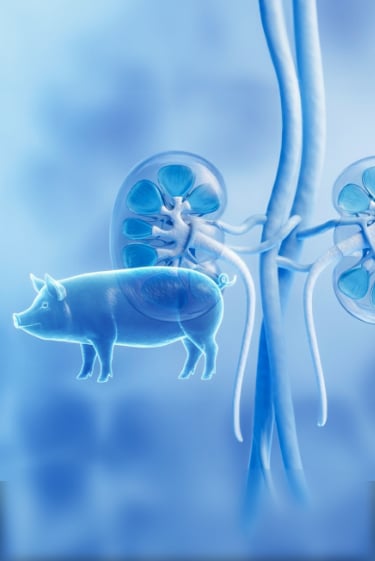 חזיר מוסר כליות