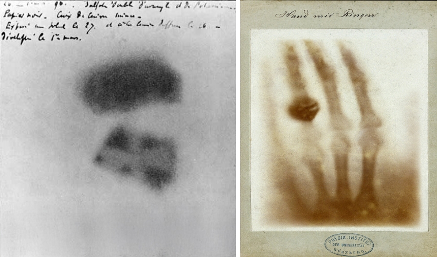 מימין כף היד של אנה ברתה לודוויג בצילום הרנטגן הראשון, 1895; משמאל לוח הצילום שהשחיר מלבד באזור צלב המתכת בתגלית של אנרי בקרל, 1896 | ויקימדיה, נחלת הכלל