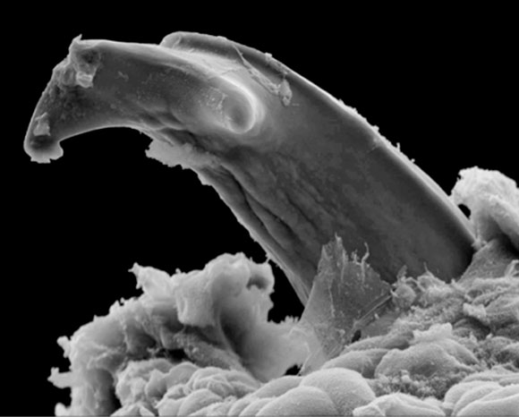 צאצאי התולענים האפריקניים אוכלים את עור אימן בעזרת שיניים מיוחדות | צילום מיקרוסקופ אלקטרונים סורק: Natural History Museum, London / Science Photo Library