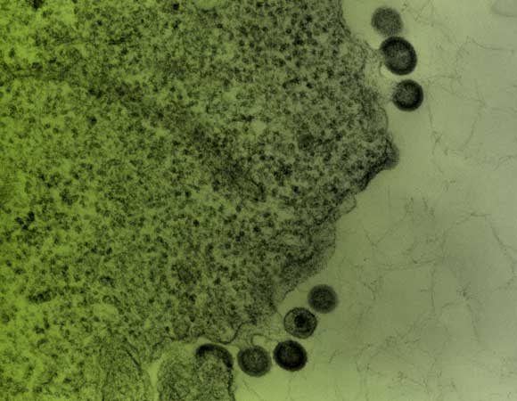 שימוש נכון בהם יכול להיות הפתרון לריפוי גני מוצלח. נגיפי HIV ברקמת לימפה | צילום: Science Photo Library