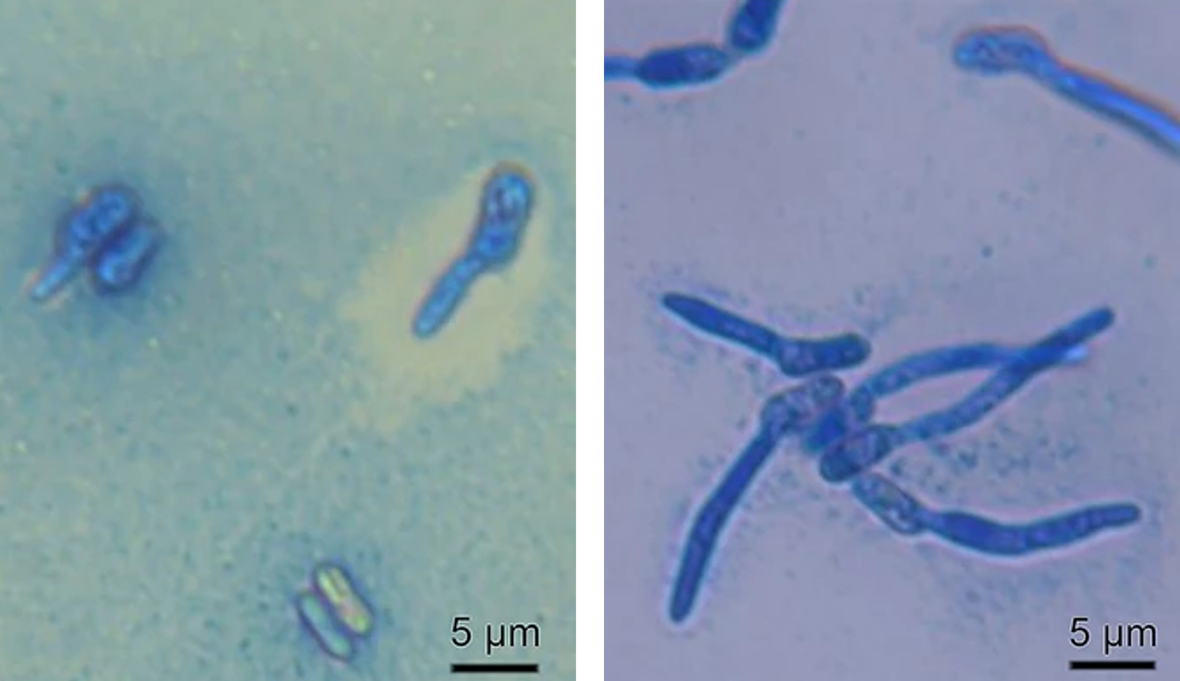 זן מטריזיום עמיד ויעיל | מתוך מאמר המחקר ,Han J.O. et al