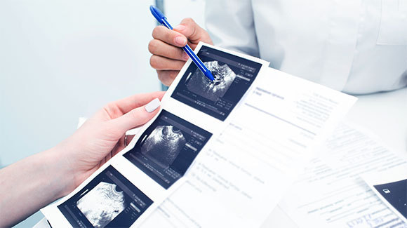 תמונות אולטראסאונד של עובר | Shutterstock, Peakstock