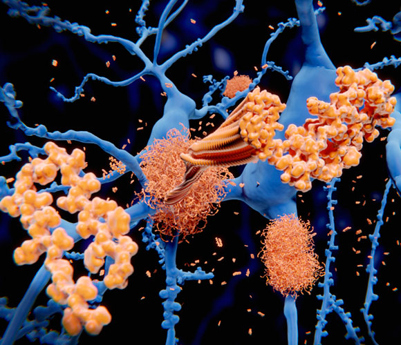 משקעי עימלואידים