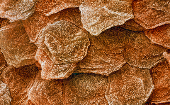 רוב האבק בבית מורכב מתאי עור שנשרו. צילום במיקרסקופ אלקטרונים של התאים באפידרמיס | מקור: Science Photo Library