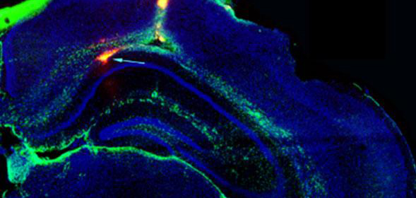 החץ מצביע על השתל (ירוק זוהר) במוקד האפילפסיה במוח העכבר | צילום: Christopher Proctor, University of Cambridge 