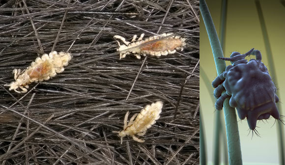 איור של כינת ערווה (מימין) וצילום של כיני ראש | מקור: SCIEPRO / SCIENCE PHOTO LIBRARY, Protasov AN, Shutterstock