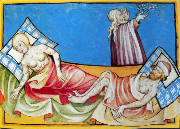 החיידק שקטל מיליונים רבים. איור של מכת הדבר במצרים, שמציג בכלל חולי שחין, מתוך "תנ"ך טוגנבורג", 1411 | מקור: ויקיפדיה, נחלת הכלל