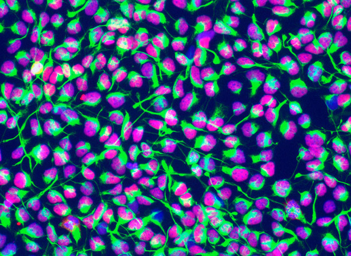 יעילים בריפוי מחלות? תרבית של תאי גזע של מערכת העצבים בצילום מיקרוסקופי צבוע | צילום: Science Photo Library
