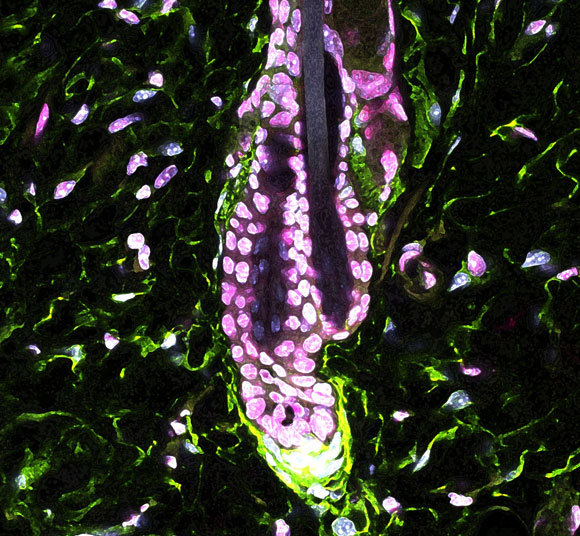 צילום במיקרוסקופ אלקטרונים | מקור: Hsu Laboratory, Harvard University