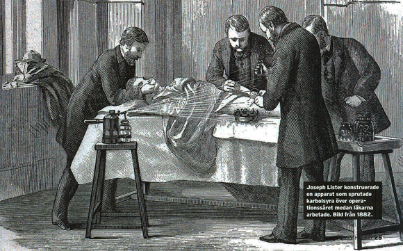 ליסטר מחטא מנותח בתרסיס פנול במהלך ניתוח. רישום משנת 1882 | מקור: ויקיפדיה, נחלת הכלל