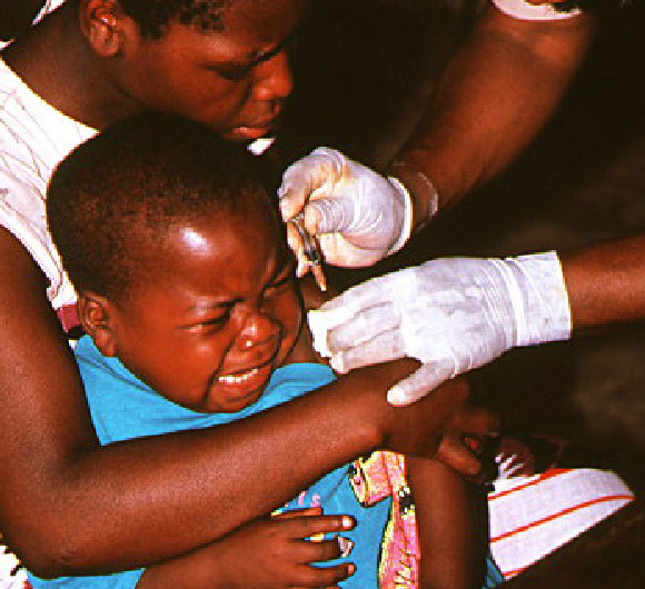 ילד מקבל חיסון מלריה במסגרת ניסוי רחב היקף | צילום: ANDY CRUMP, TDR, WHO / SCIENCE PHOTO LIBRARY