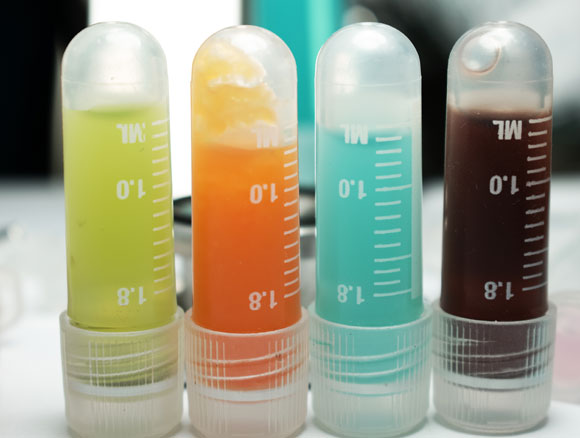 טיפולים אימונתרפיים במבחנה | צילום: Shutterstock