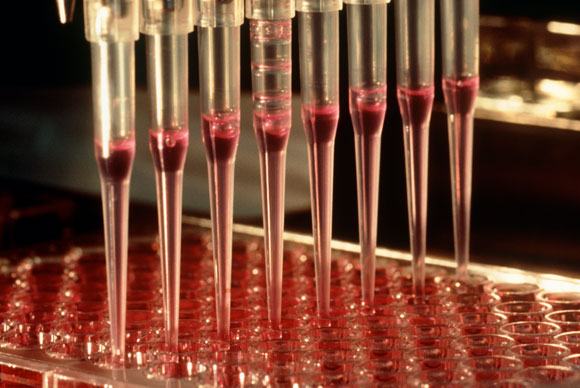 אינטרלוקין 2 מעודד התרבות של תאי T וכך מגביר את תגובת מערכת החיסון | צילום: Philippe Plailly / Science Photo Library