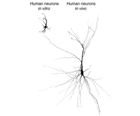 תא מאורגנואיד בתרבית (משמאל) לצד תא מאורגנואיד במוח חולדה | Sergiu Pasca