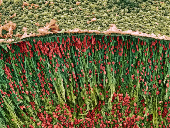 צילום מיקרוסקופ אלקטרונים של תאי מוח בשלב העוברי