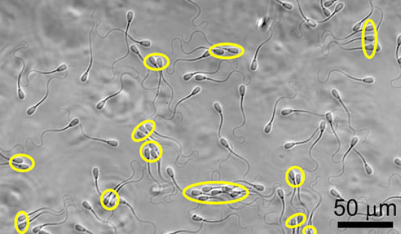 תאי זרע של פר | מקור: S Phuyal, SS Suarez, C-K Tung