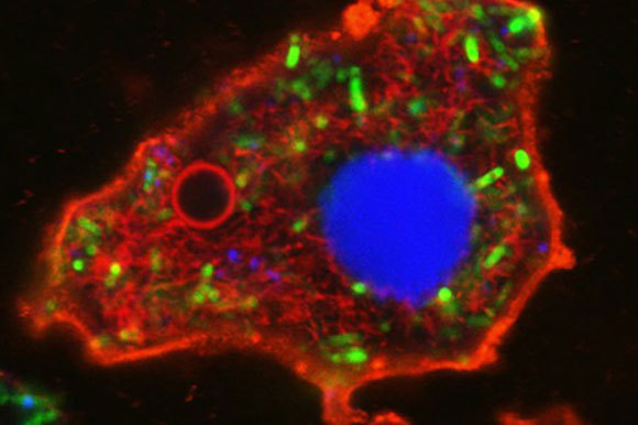 אחד התאים במחקר, מראה מבנה דמוי-גרעין וצורה של אמבה | מקור: Professor Stephen Mann and Dr Can Xu