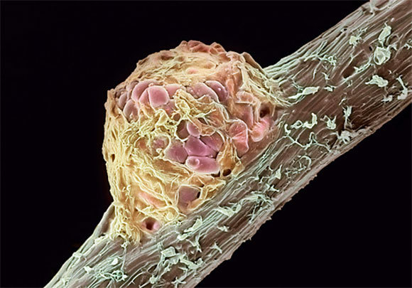 תמונת מיקרוסקופ אלקטרונים של חיידקים החיים על שורש של אפונה | Dr. Jeremy Burgess, Science Photo Library