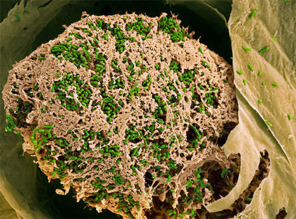 פקעיות על שורש של אפונה | Dr. Jeremy Burgess, Science Photo Library