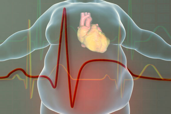 איור של מחלת לב באדם שמן | מקור: Kateryna Kon, Shutterstock