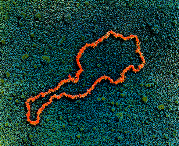 צילום במיקרוסקופ אלקטרונים, עם צביעה, של אחד הפלסמידים שייצרו כהן ובויר | מקור: PROFESSOR STANLEY COHEN / SCIENCE PHOTO LIBRARY