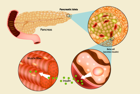 בסוכרת התהליך התקין משתבש | איור: Sakurra, Shutterstock
