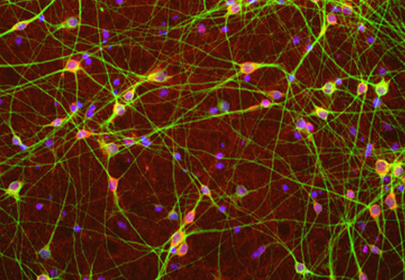 תמונת מיקרוסקופ של תאי עצב המפרישים גאבה | Wikipedia, Neuron Experts