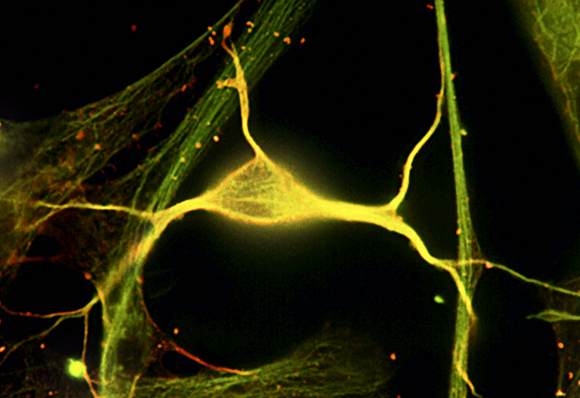 תא עצב בהיפוקמפוס | Robert Mcneil, Baylor College of Medicine, Science Photo Library