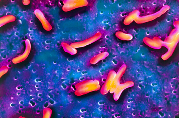 התפשטות באדיבות שינויי האקלים. צילום במיקרסקופ אלקטרונים סורק (צבוע) של חיידקי כולרה | מקור: BSIP VEM / SCIENCE PHOTO LIBRARY