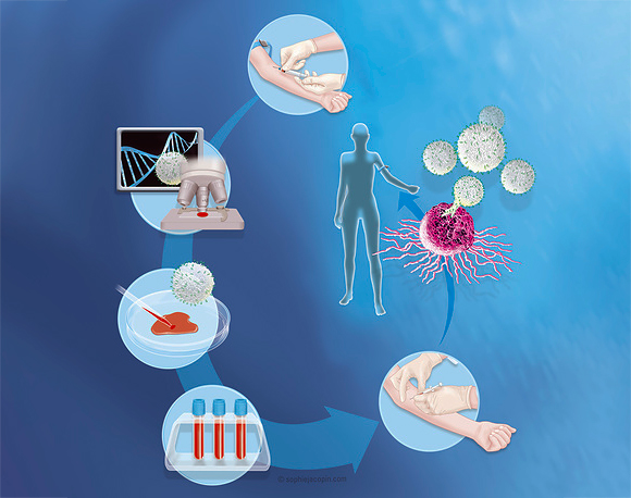 **אילוסטרציה של איך מייצרים תאי CAR-T**